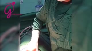 جراحی همزمان پروستات و سنگ مثانه