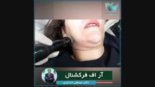 فیلم آر اف فرکشنال