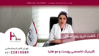 کاشت ابرو روی اسکار | کلینیک هلیا | 09120687738