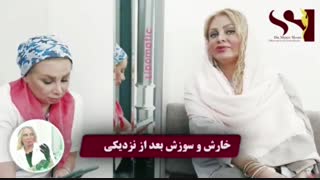 علت خارش و سوزش بعد از رابطه جنسی