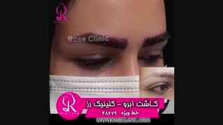 فیلم کاشت ابرو | کلینیک رز | 02148679 | شماره 226