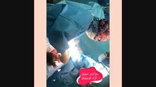 فیلم سزارین واقعی