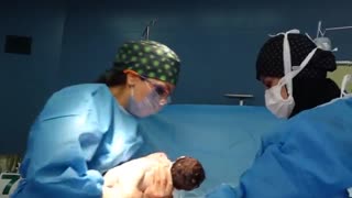 زایمان سزارین با دکتر ندا حاجیها