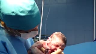 فیلم جراحی سزارین