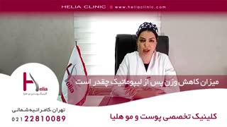 میزان کاهش وزن پس از لیپوماتیک چقدر است | کلینیک هلیا
