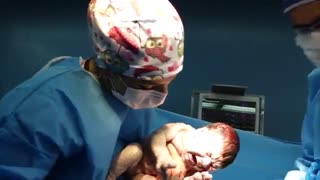 عمل زایمان سزارین در تهران