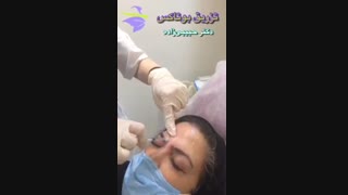 فیلم تزریق بوتاکس