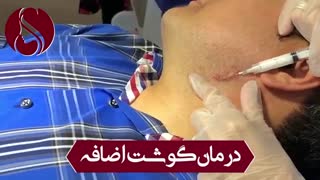 فیلم واقعی از بین بردن گوشت اضافی روی پوست