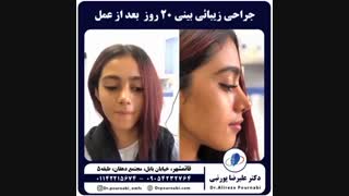 جراحی زیبائی بینی