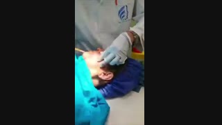 فیلم مراحل تزریق چربی به صورت بلیچینگ دندان