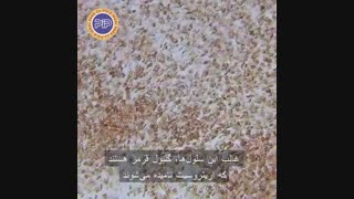 نمای میکروسکوپی از گلبول های قرمز خون