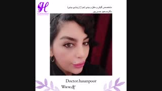 نتیجه جراحی بینی دکتر مسعود حسن پور