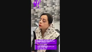 چسب زدن روی بینی