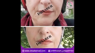 جوانسازی صورت