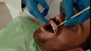 لمینت دندانها | کلینیک سیمادنت