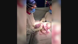 فیلم کامل زایمان سزارین