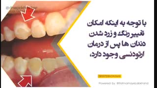 بلیچینگ و ارتودنسی | دکتر سپیده دادگر