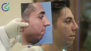 فیلم عمل بینی مردانه