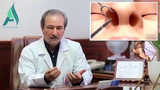 جراحی بینی های گوشتی