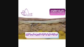 انیمیشن درمان ترک های پوستی با لیزر جراحی بینی