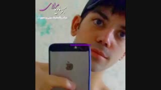 جراحی بینی مردانه