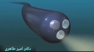 کولونوسکوپی چگونه انجام می شود؟