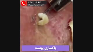 تخلیه جوش 2