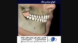 دکتر علیرضا پورنبی-Drpournabi (@dr.pournabi_omfs) • Instagram photos and videos_3