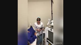 فیلم واقعی لیزر کردن با دستگاه Thunder