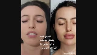 آموزش تزریق ژل یا فیلر کامل☝و انجام کار جراحی فک