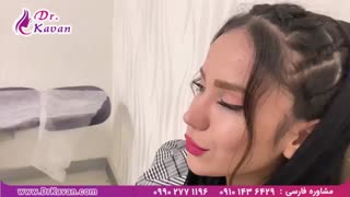 رضایت از عمل بینی