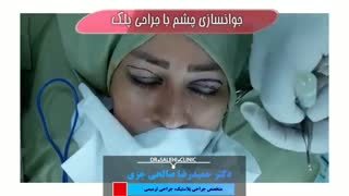 فیلم واقعی جراحی پلک
