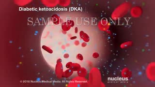 خطرات دیابت