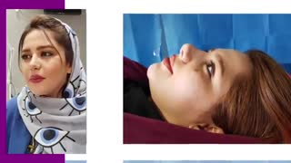 فیلم نمونه واقعی از جراحی بینی تقریبا گوشتی