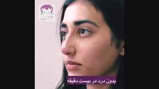 فرم دهی بینی با تزریق ژل