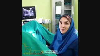 فیلم انتقال جنین با بیهوشی