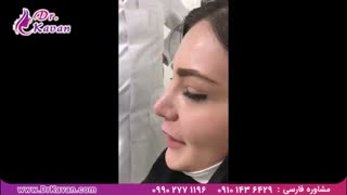 رضایت از عمل بینی