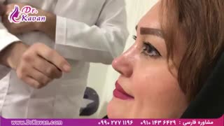 رضایت از عمل بینی