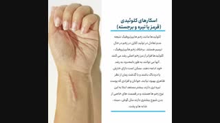 انواع جای زخم و دلایل ایجاد آنها را بشناسید