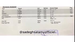 تومورهای مغزی