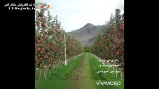 سیمین نهال (مهندس عیوضی) در میاندوآب پوسیدگی دندان