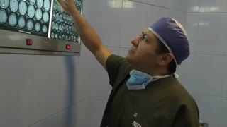 تشنج به دنبال تومور مغزی در آقای جوان