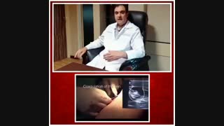 لیزر واریس اندام تحتانی