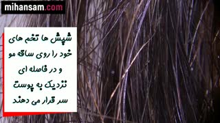 شامپو ضد شپش خارجی دیفنوترین برای دفع قطعی شپش و تخم شپش