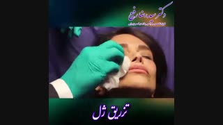 تزریق ژل توسط دکتر رضا رفیع | فوق تخصص جراحی پلاستیک و زیبایی
