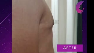 جراحی کوچک کردن سینه آقایان ترمیم دندان