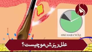 فیلم کامل در مورد علل ریزش مو
