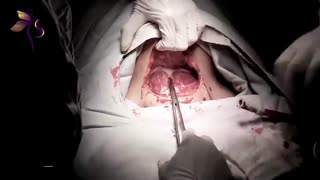 از قبل تا بعد از زایمان سزارین