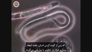 بروگیا مالایی