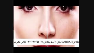 کرم ضد لک 5040 خوبه آکنه